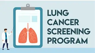 Lung Cancer Screening Programme being rolled out in 2026